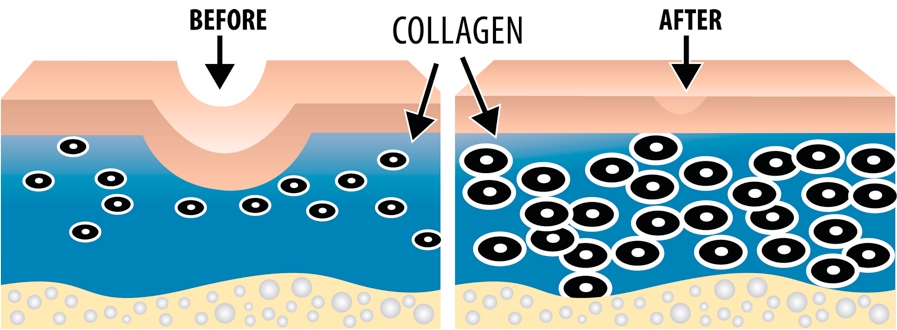 Tác dụng của collagen Giữ mãi tuổi thanh xuân với viên uống làm đẹp da 02