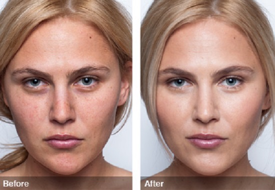 Nubest Lady - Viên uống sáng da, chống lão hóa 