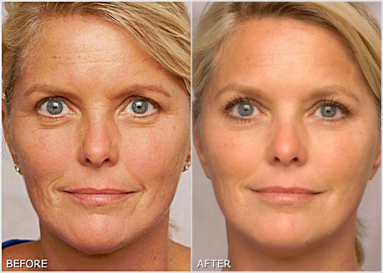 Nubest Lady - Viên uống sáng da của Mỹ