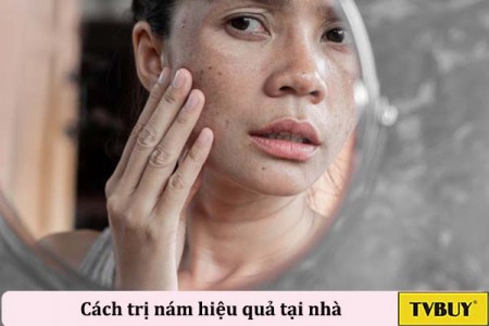 #10 cách trị nám da từ các nguyên liệu có sẵn trong nhà bếp