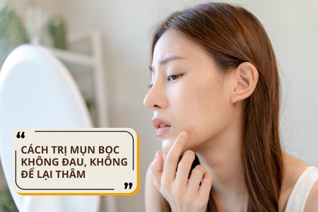 Tìm ra cách trị mụn bọc không đau, không để lại thâm Tìm ra cách trị mụn bọc không đau, không để lại thâm