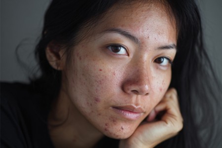 Các yếu tố khiến da của bạn nhanh xuống cấp Các yếu tố khiến da của bạn nhanh xuống cấp