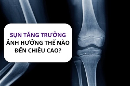 Sụn tăng trưởng có ảnh hưởng như thế nào đến chiều cao? Sụn tăng trưởng có ảnh hưởng như thế nào đến chiều cao?