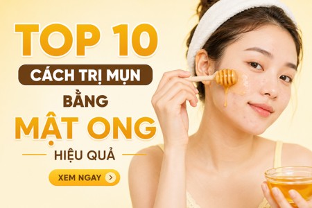 Top 10 cách trị mụn bằng mật ong hiệu quả Top 10 cách trị mụn bằng mật ong hiệu quả