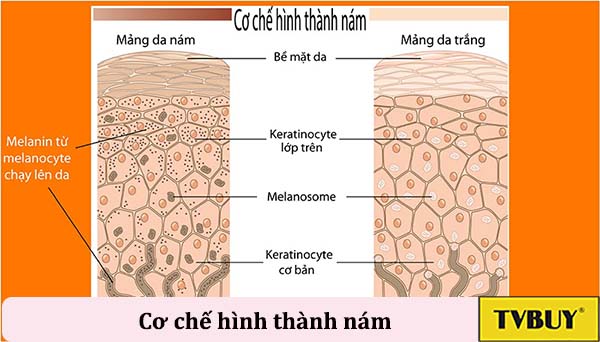 nguyên nhân gây nám