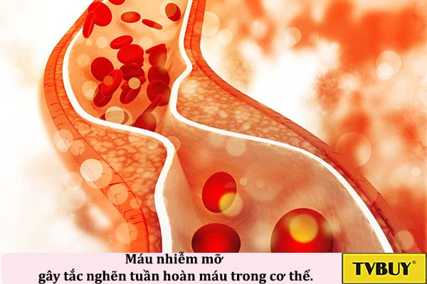 Máu nhiễm mỡ gây tắc nghẽn tuần hoàn máu trong cơ thể.