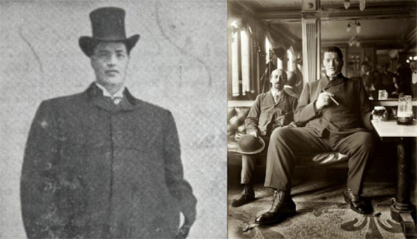 Adam Rainer mắc phải bệnh Acromegaly khiến chiều cao phát triển bất bình thường dù đã qua tuổi trưởng thành