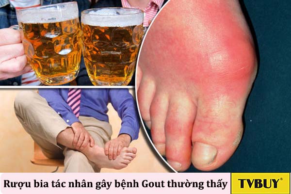 nguyên nhân gây bệnh gout