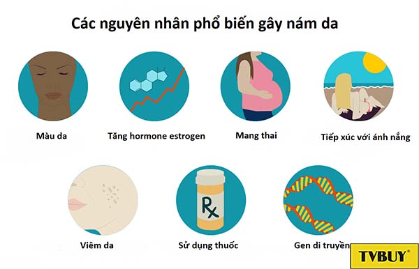 nguyên nhân gây nám sạm da