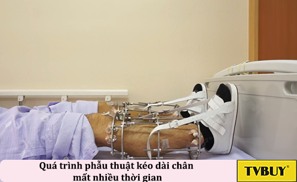 tạc dụng phụ của phẫu thuật kéo dài chân
