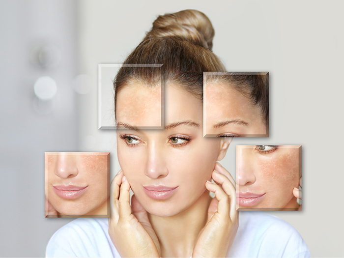 Có nhiều loại da với đặc điểm và cách chăm sóc khác nhau