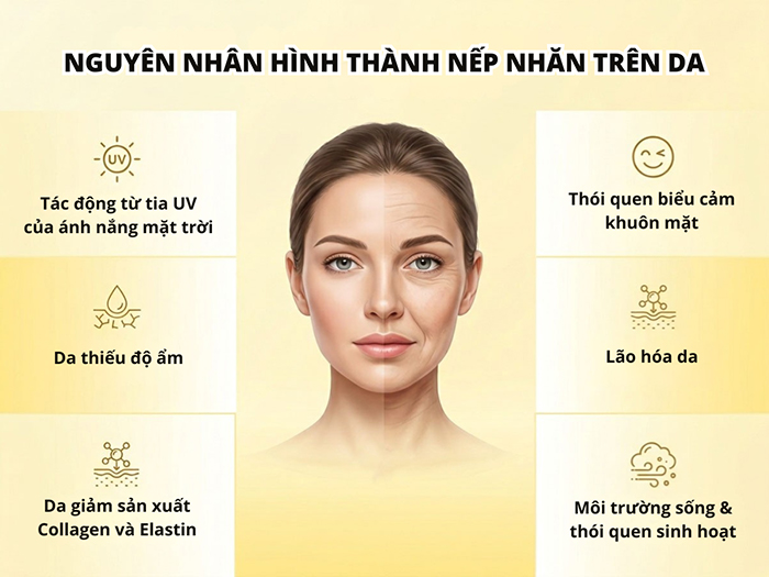 Nguyên nhân chính khiến da bạn xuất hiện nếp nhăn.