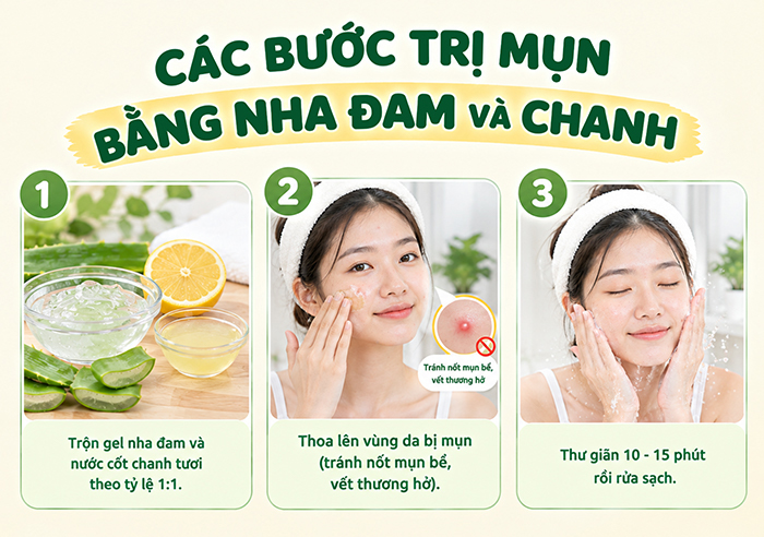 Các bước trị mụn bằng nha đam và nước cốt chanh tươi.