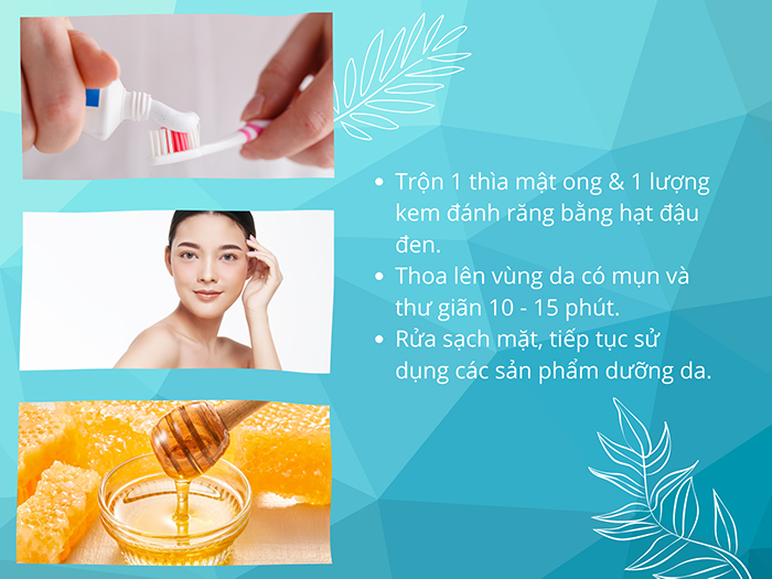 Trị mụn bằng kem đánh răng và mật ong