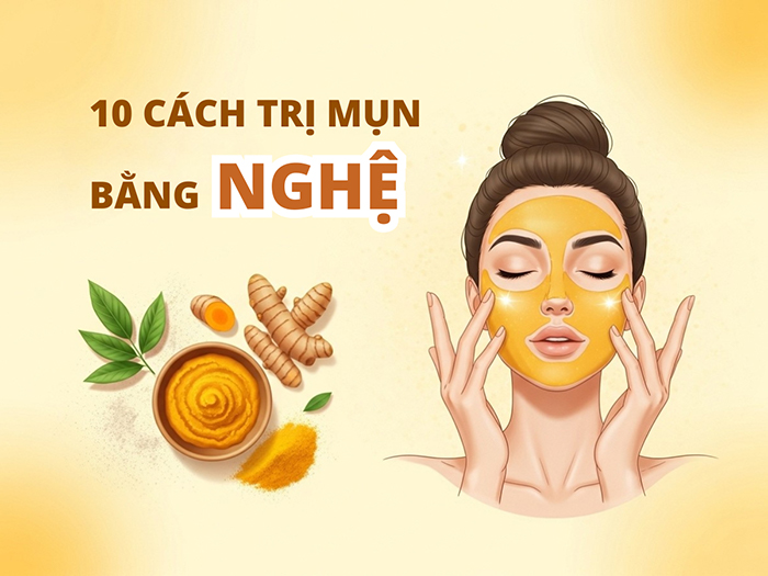 Có thể điều trị mụn bằng nghệ và các nguyên liệu tự nhiên khác.