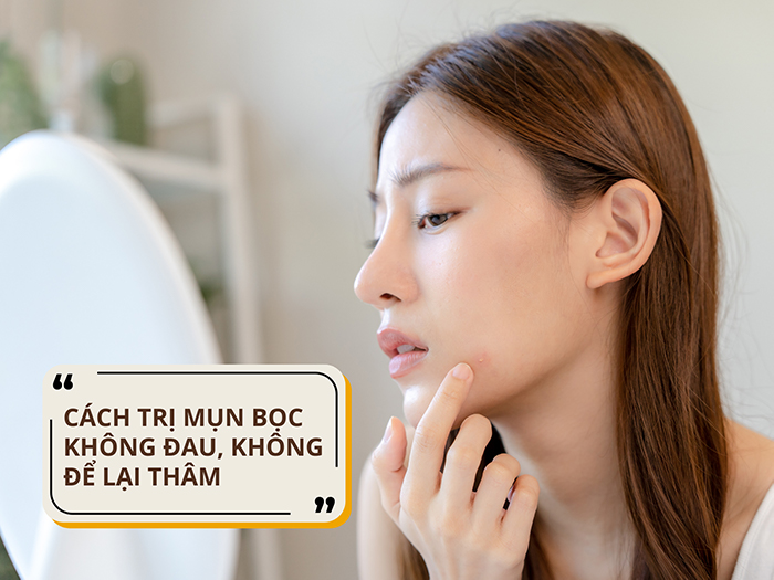 Điều trị mụn bọc hiệu quả giúp bạn lấy lại làn da mịn màng