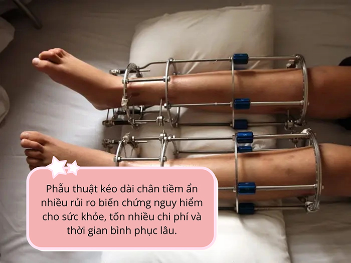 Phẫu thuật kéo dài xương tiềm ẩn nhiều rủi ro