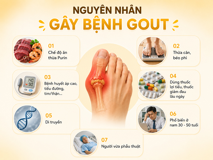 Nguyên nhân gây bệnh Gout chủ yếu từ lối sống hằng ngày.