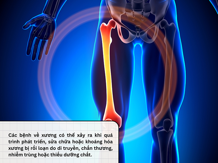 Tổng hợp các bệnh lý phổ biến liên quan đến xương