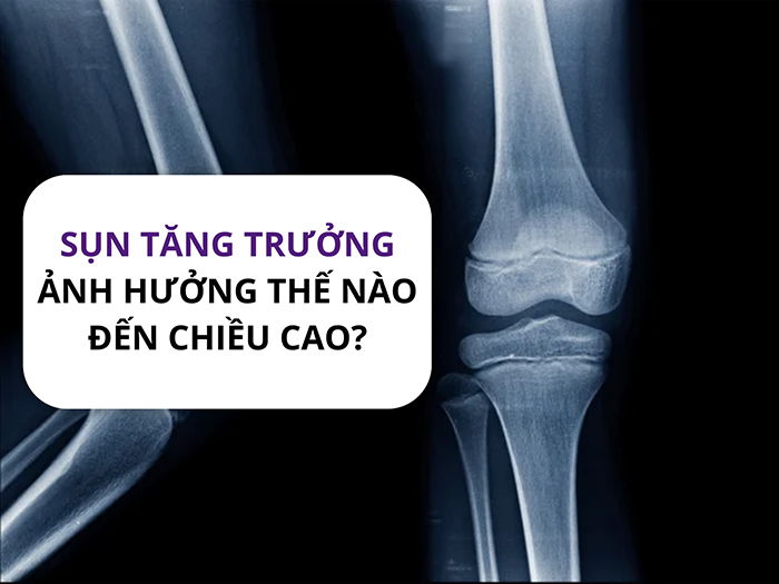 Sụn tăng trưởng có ảnh hưởng ra sao đến chiều cao và thể chất?