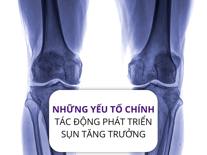Những yếu tố chính ảnh hưởng đến sự phát triển của sụn tăng trưởng