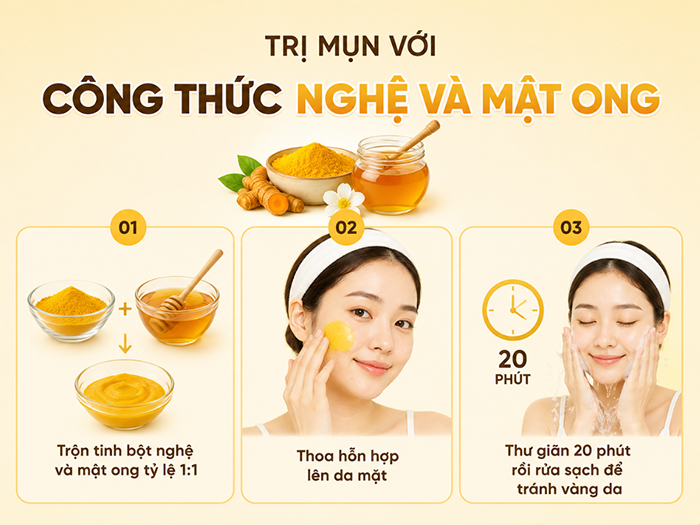 Cách trị mụn với công thức nghệ và mật ong.