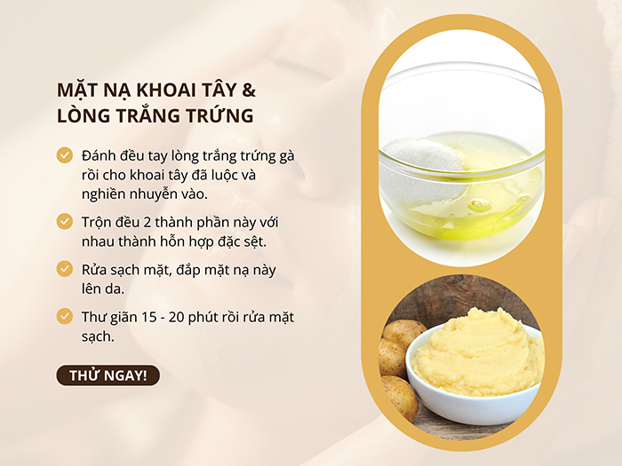 Cách trị nám bằng mặt nạ khoai tây và lòng trắng trứng