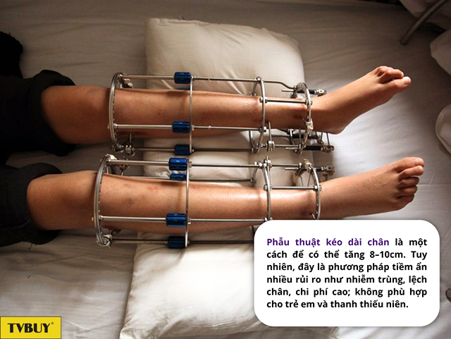 Phẫu thuật kéo dài chân tiềm ẩn nhiều rủi ro