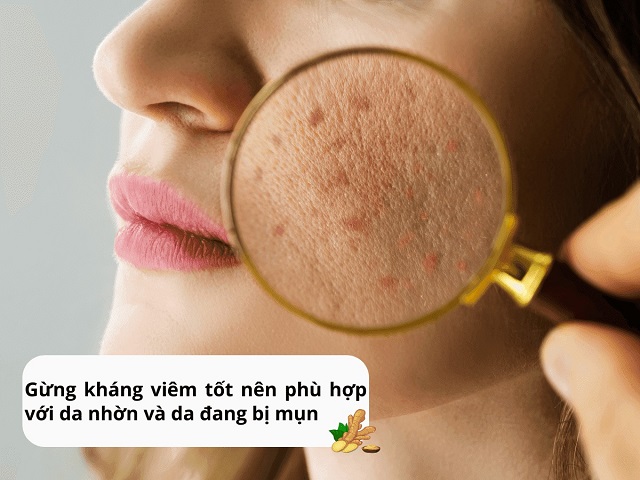 Gừng phù hợp để chăm sóc cho các loại da nhờn và bị mụn