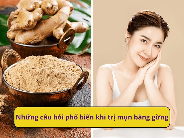 Tổng hợp những câu hỏi thường gặp về phương pháp trị mụn bằng gừng