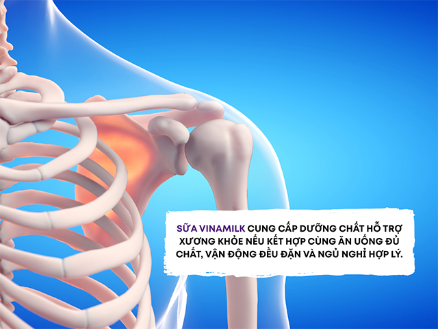 Xương khớp khỏe mạnh giúp trẻ dễ dàng tham gia các hoạt động thể chất